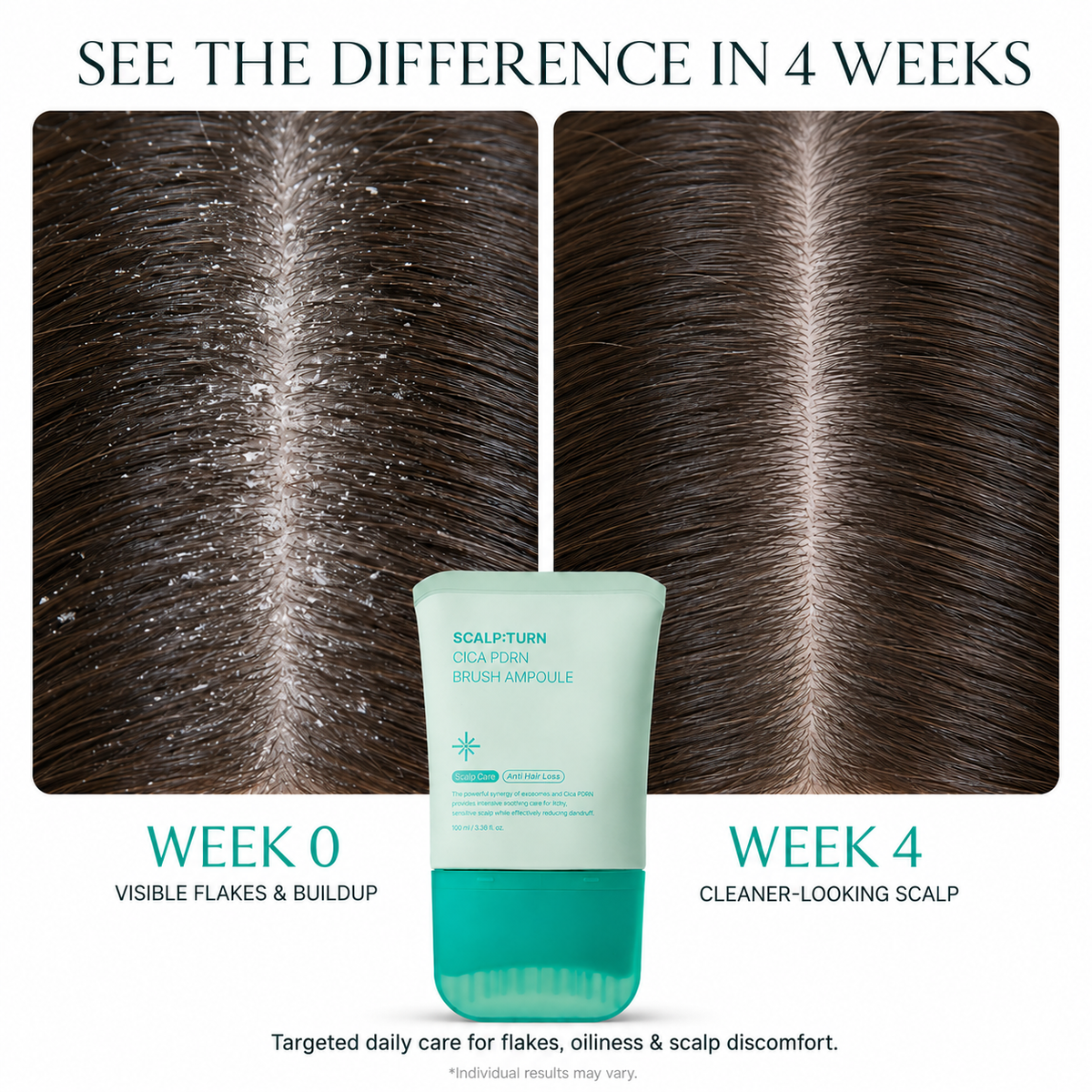 The Lily Scalp & Growth Serum