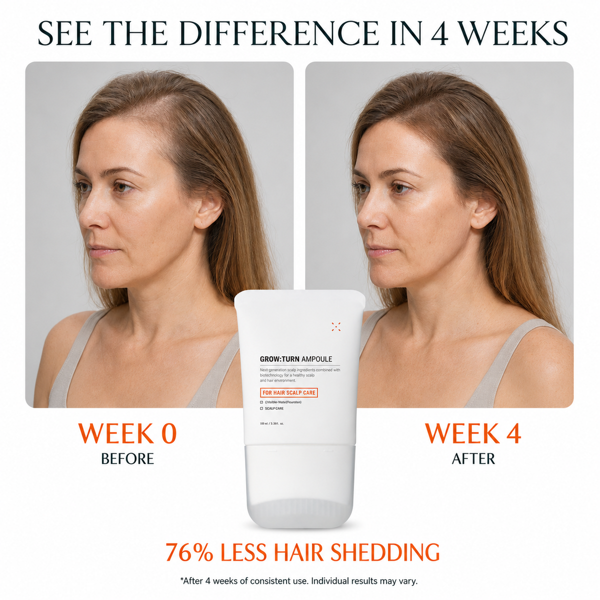 The Lily Scalp & Growth Serum